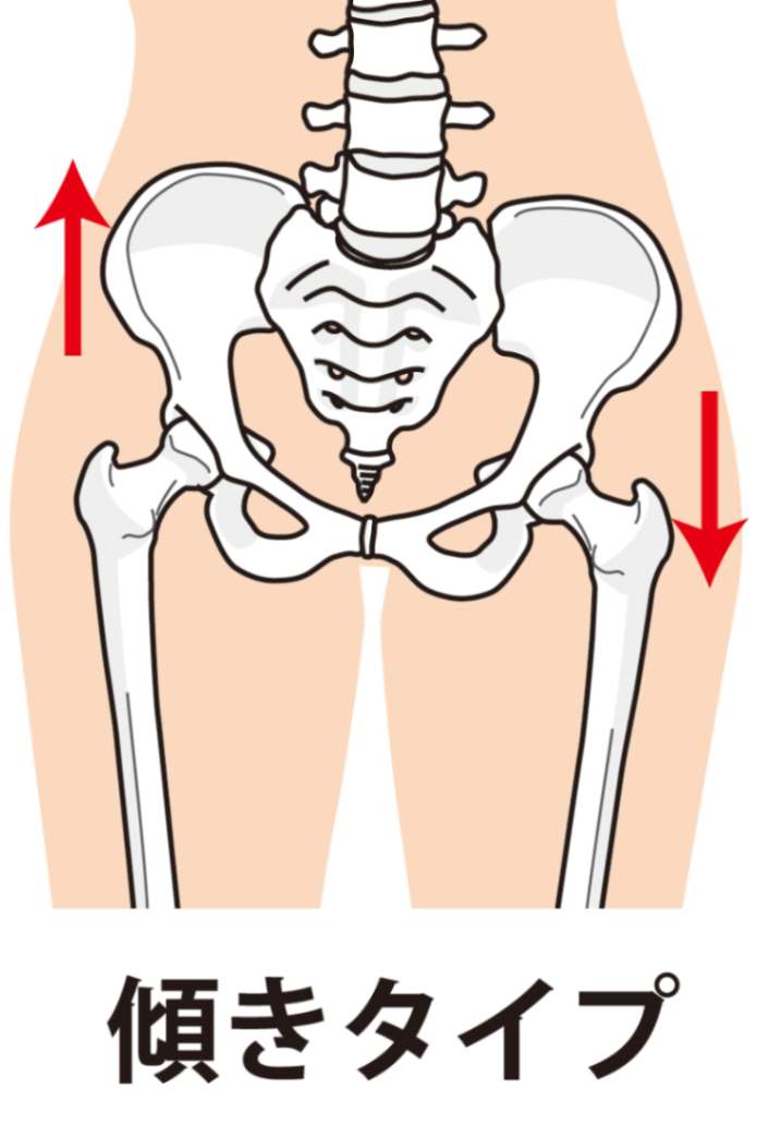 熊本市での姿勢改善の重要性